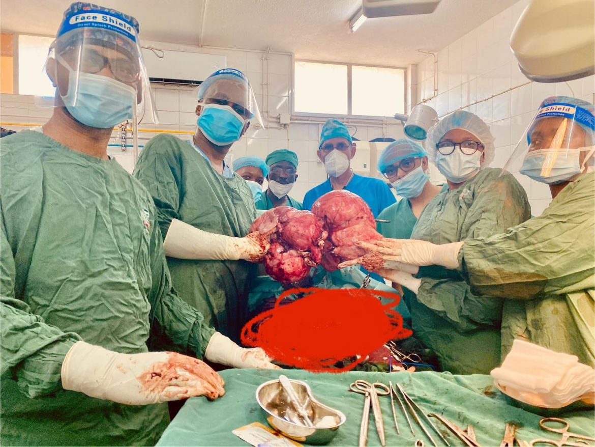 Médicos do HCN removem tumor de mais de 10 quilos